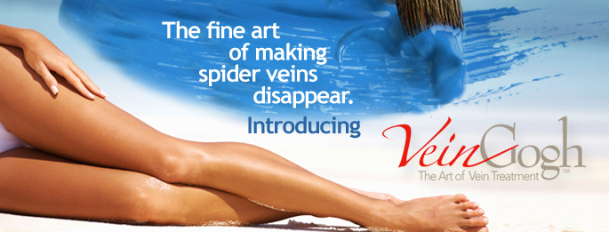 Vein Gogh: The fine art of making veins disappear.